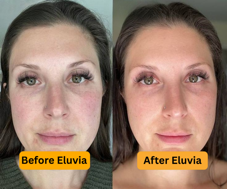 Eluvia Skin Revive Night Mask