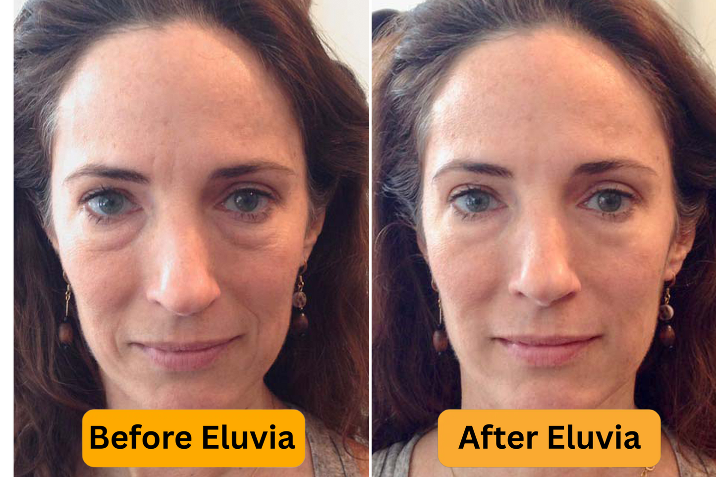 Eluvia RadiantC Youth Renewal Serum