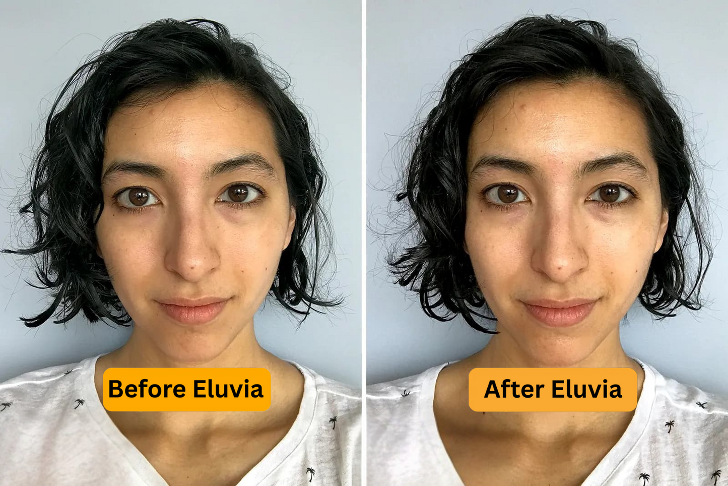 Luxury Steel Skincare Roller