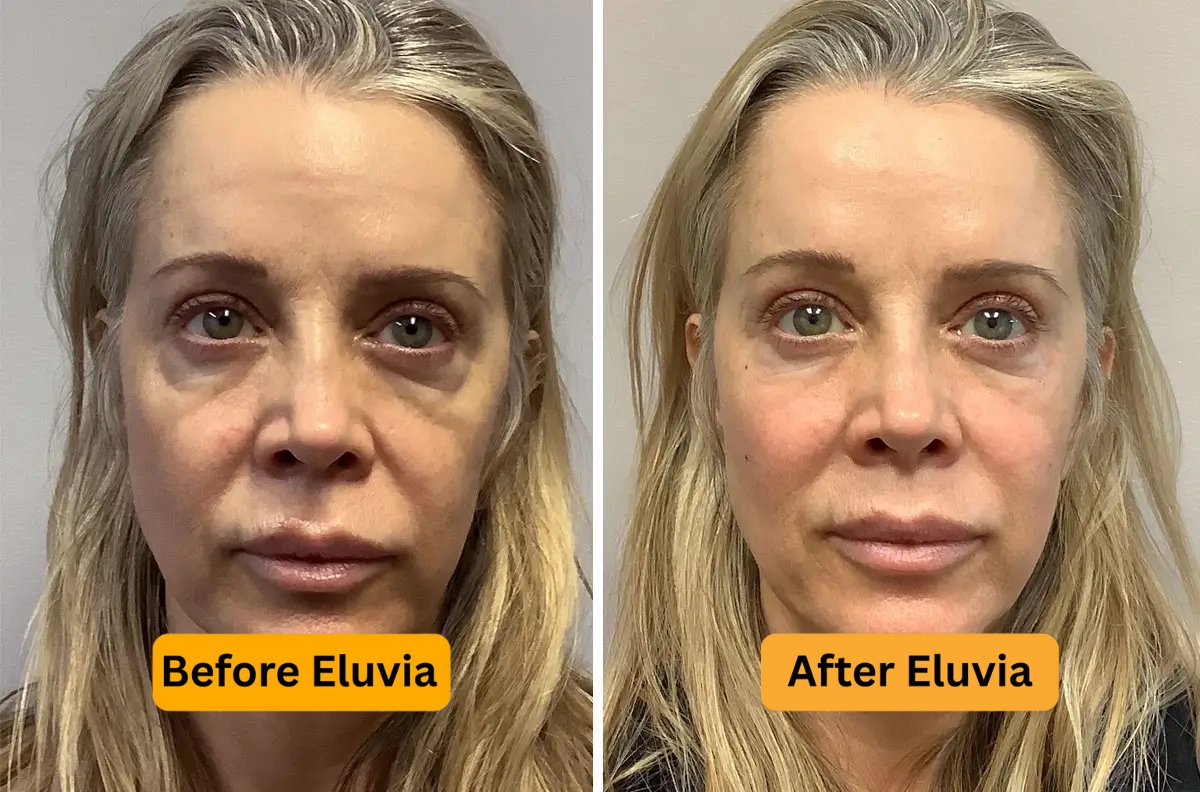 Eluvia LumaClear Cream for Dark Pigment & Skin Renewal