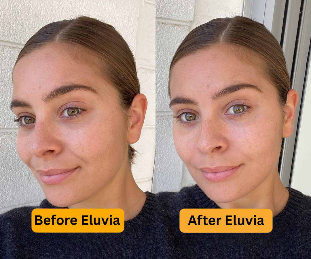Eluvia LumaClear Cream for Dark Pigment & Skin Renewal